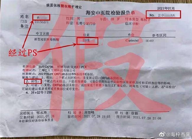 核酸检测是怎样检测 核酸检测是怎样检测