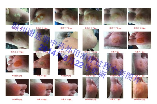 【为什么得猴子,为什么会长猴子瘊子】 【为什么得猴子,为什么会长猴子瘊子】