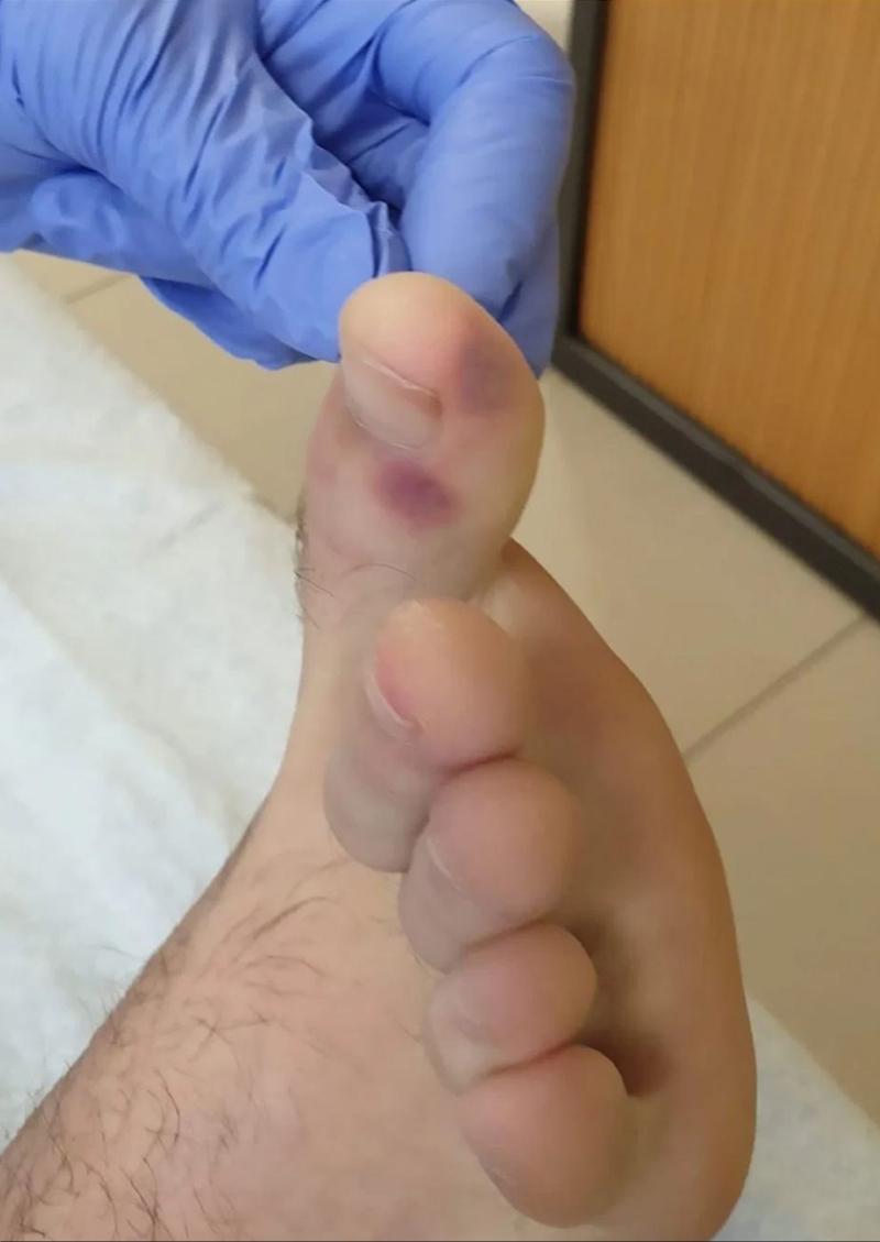 无症状感染者用治疗吗?/无症状感染者需要治疗吗 知乎 无症状感染者用治疗吗?/无症状感染者需要治疗吗 知乎
