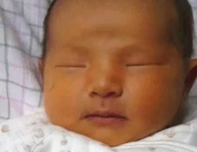 母亲喝中药婴儿转阴/妈妈吃中药可以退婴儿黄疸吗 母亲喝中药婴儿转阴/妈妈吃中药可以退婴儿黄疸吗