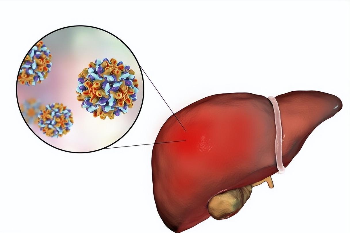 【新冠抗原检查是什么意思,新冠抗原检查是什么意思图片】 【新冠抗原检查是什么意思,新冠抗原检查是什么意思图片】