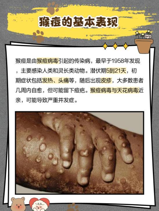 沈阳猴痘患者在哪里治疗,权威指南与防控措施 沈阳猴痘患者在哪里治疗,权威指南与防控措施