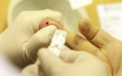 艾滋病初期症状概率多大（艾滋病初期预兆）