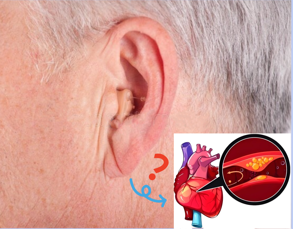 冠心病早期有什么症状/冠心病早期有什么症状看耳朵 冠心病早期有什么症状/冠心病早期有什么症状看耳朵