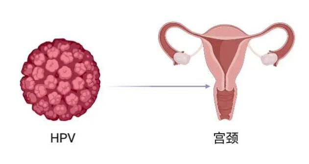 当HPV再次阳性,这不是简单的复发,而是健康的再次提醒 当HPV再次阳性,这不是简单的复发,而是健康的再次提醒