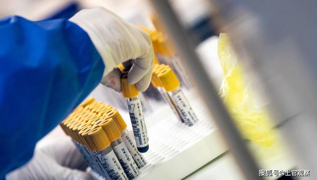 【核酸检测为阴性是什么结果/核酸检测为阴性是否正常?】 【核酸检测为阴性是什么结果/核酸检测为阴性是否正常?】