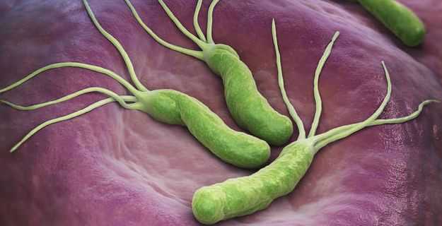 阳性没有症状/幽门螺旋杆菌阳性没有症状