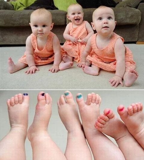 5岁双胞胎/5岁双胞胎坎断脚筋后续爷爷说真相