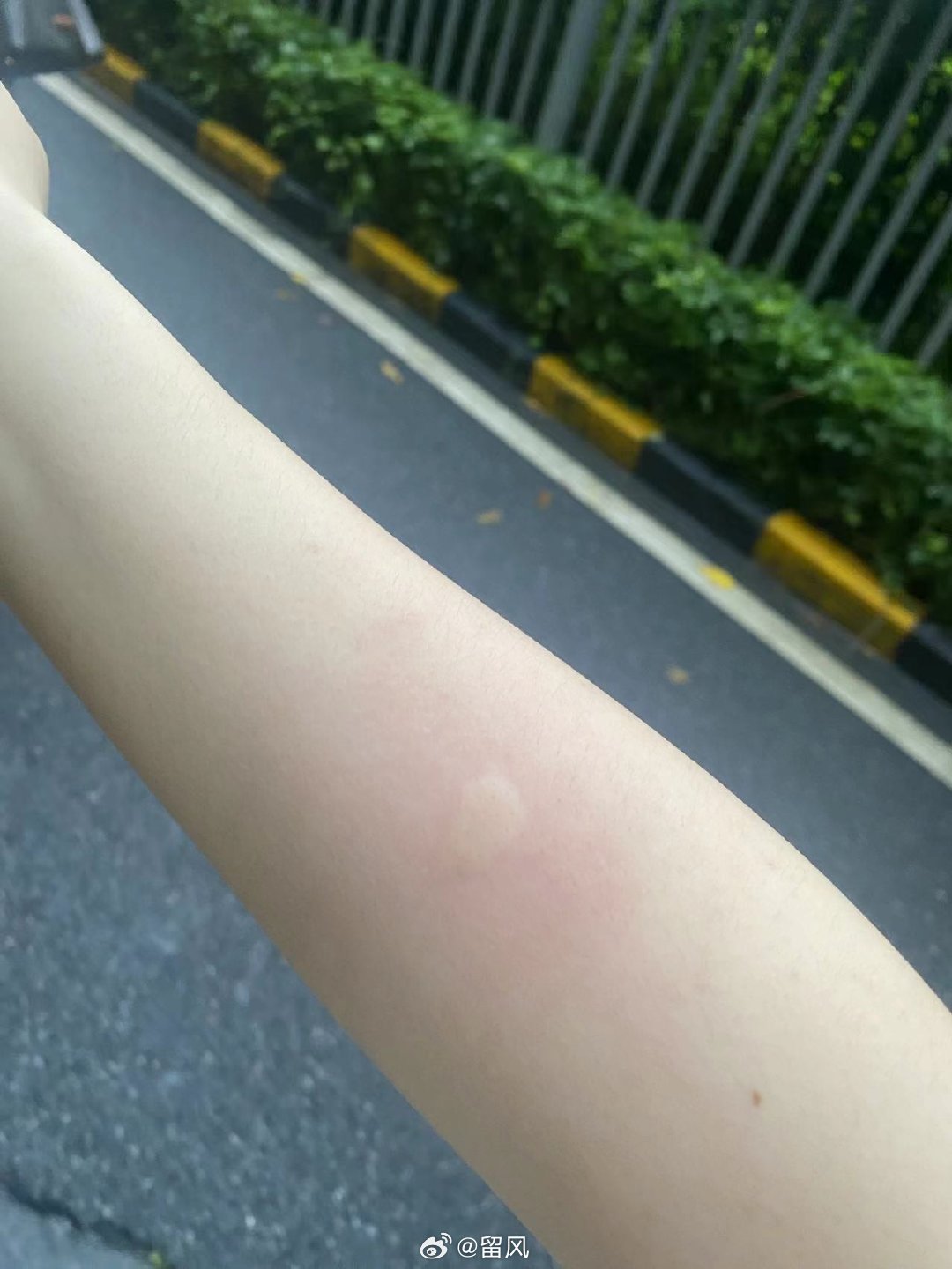 广州疫情蚊子（广州疫情蚊子咬了图片）