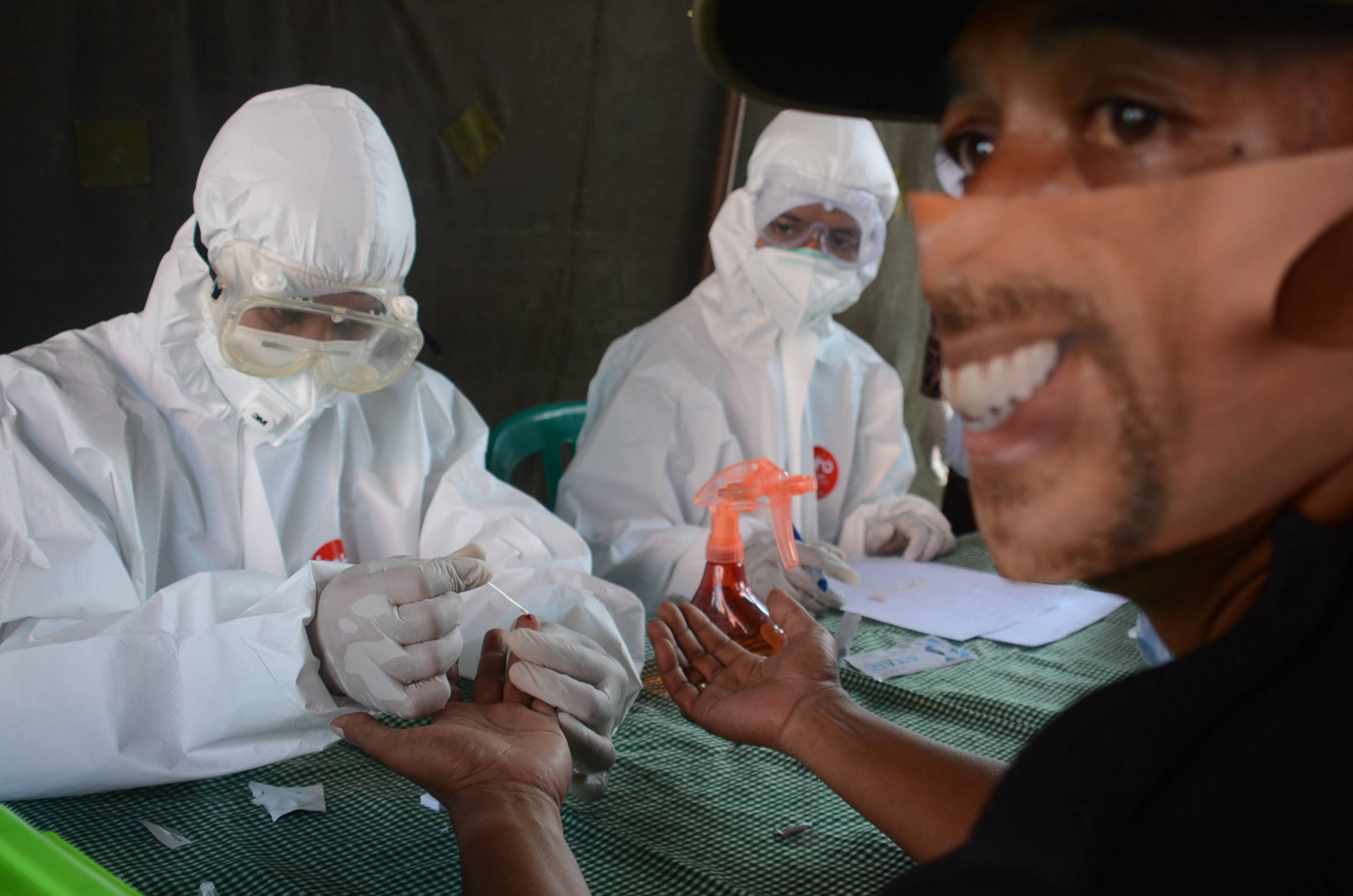 【印尼的病情,印尼确诊1155例】 【印尼的病情,印尼确诊1155例】