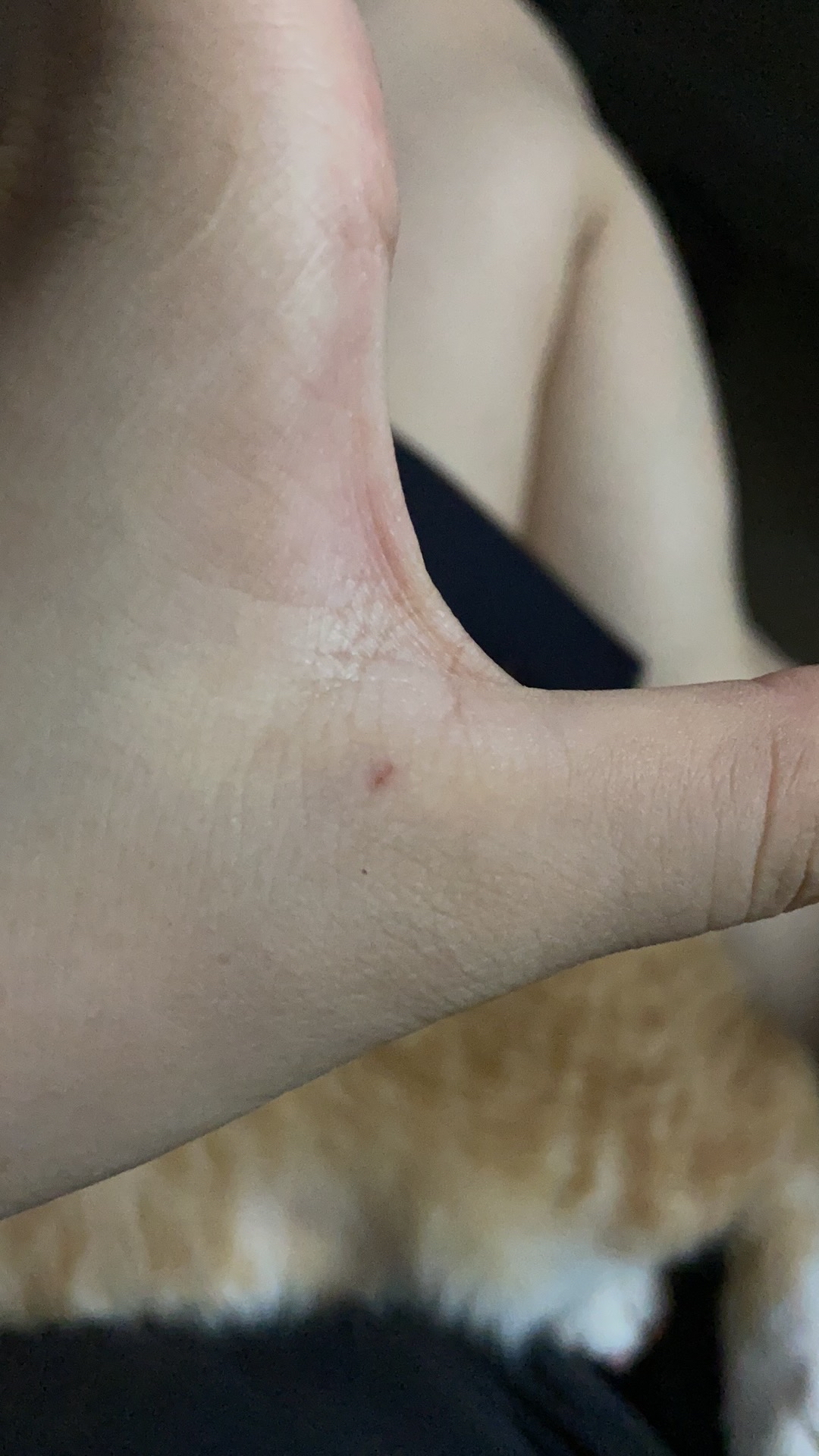 【我被猫咬了,没去打针,会不会死,被猫猫咬了没打针会得病吗】 【我被猫咬了,没去打针,会不会死,被猫猫咬了没打针会得病吗】