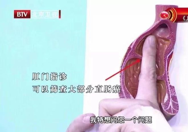 一家十口确诊:一家全部确诊 一家十口确诊:一家全部确诊