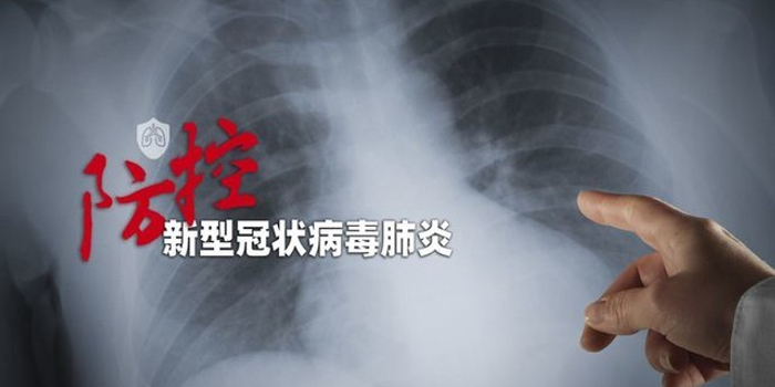 头疼是得了新冠肺炎吗/头疼是新冠肺炎的症状吗? 头疼是得了新冠肺炎吗/头疼是新冠肺炎的症状吗?