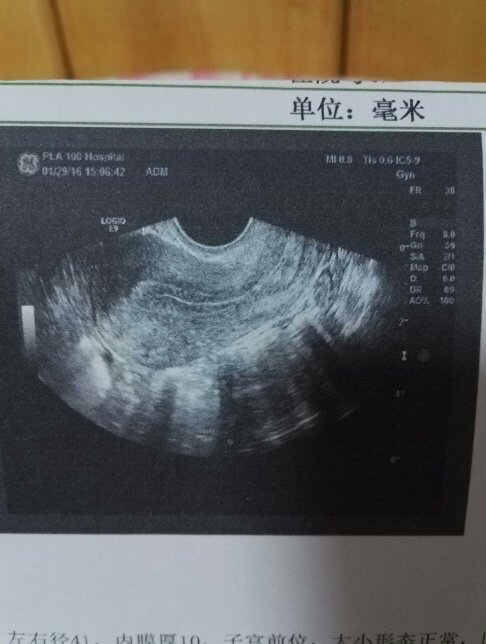 【测核酸没认出妻子怎么处理/核酸检测不去也没有人知道】 【测核酸没认出妻子怎么处理/核酸检测不去也没有人知道】