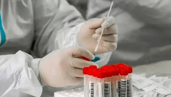 密接几天能检测出来/密接后几天有传染性 密接几天能检测出来/密接后几天有传染性