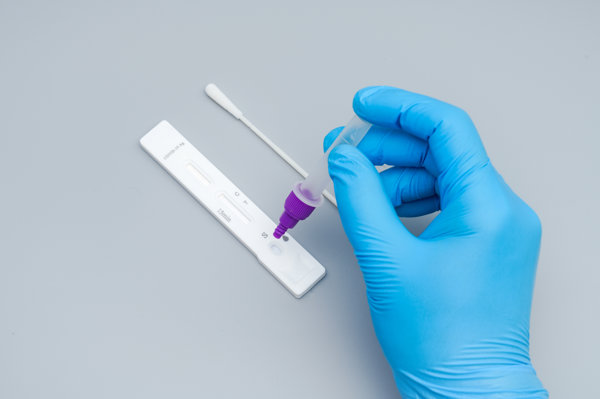 核酸检测怎么检测艾滋病(核酸检测怎么检测艾滋病毒) 核酸检测怎么检测艾滋病(核酸检测怎么检测艾滋病毒)