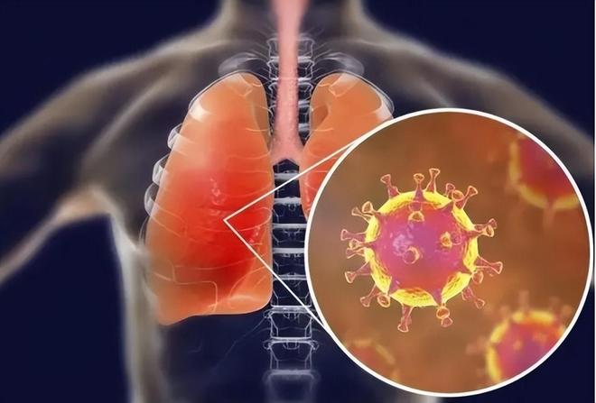 最新新冠病毒感染什么症状:最新新冠病毒感染什么症状2024年8月