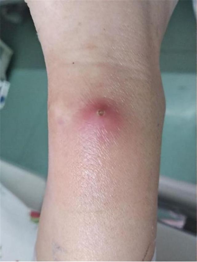 备孕男性可以接种新冠疫苗吗？科学解析与专家建议