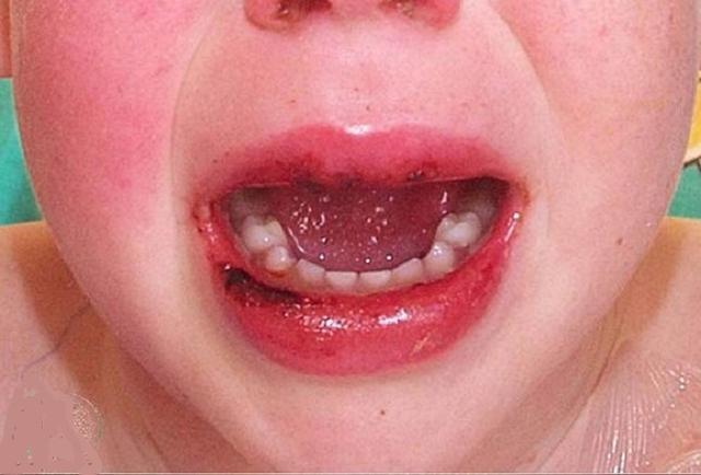 【四川新增新冠肺炎确诊病例3例/四川新增确诊3例新型肺炎病例】