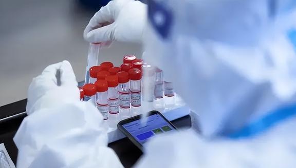 新冠核酸检测与抗原检测,双剑合璧的科学防线 新冠核酸检测与抗原检测,双剑合璧的科学防线