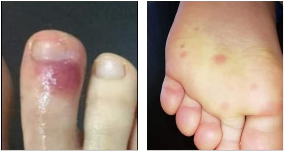 韩国新冠病毒严重吗(韩国新冠叫什么) 韩国新冠病毒严重吗(韩国新冠叫什么)