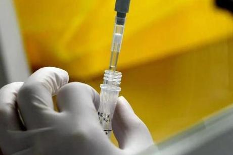 核算检测结果阳性/核酸检测报告阳性