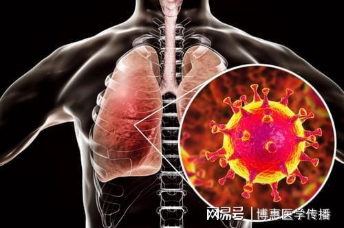 【新冠阳性不发热/新冠阳性不发热了还有传染性吗】 【新冠阳性不发热/新冠阳性不发热了还有传染性吗】