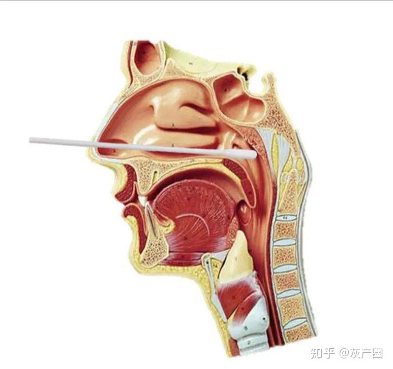 咽拭子阳性需要治疗吗:咽拭子阳性有什么症状 咽拭子阳性需要治疗吗:咽拭子阳性有什么症状