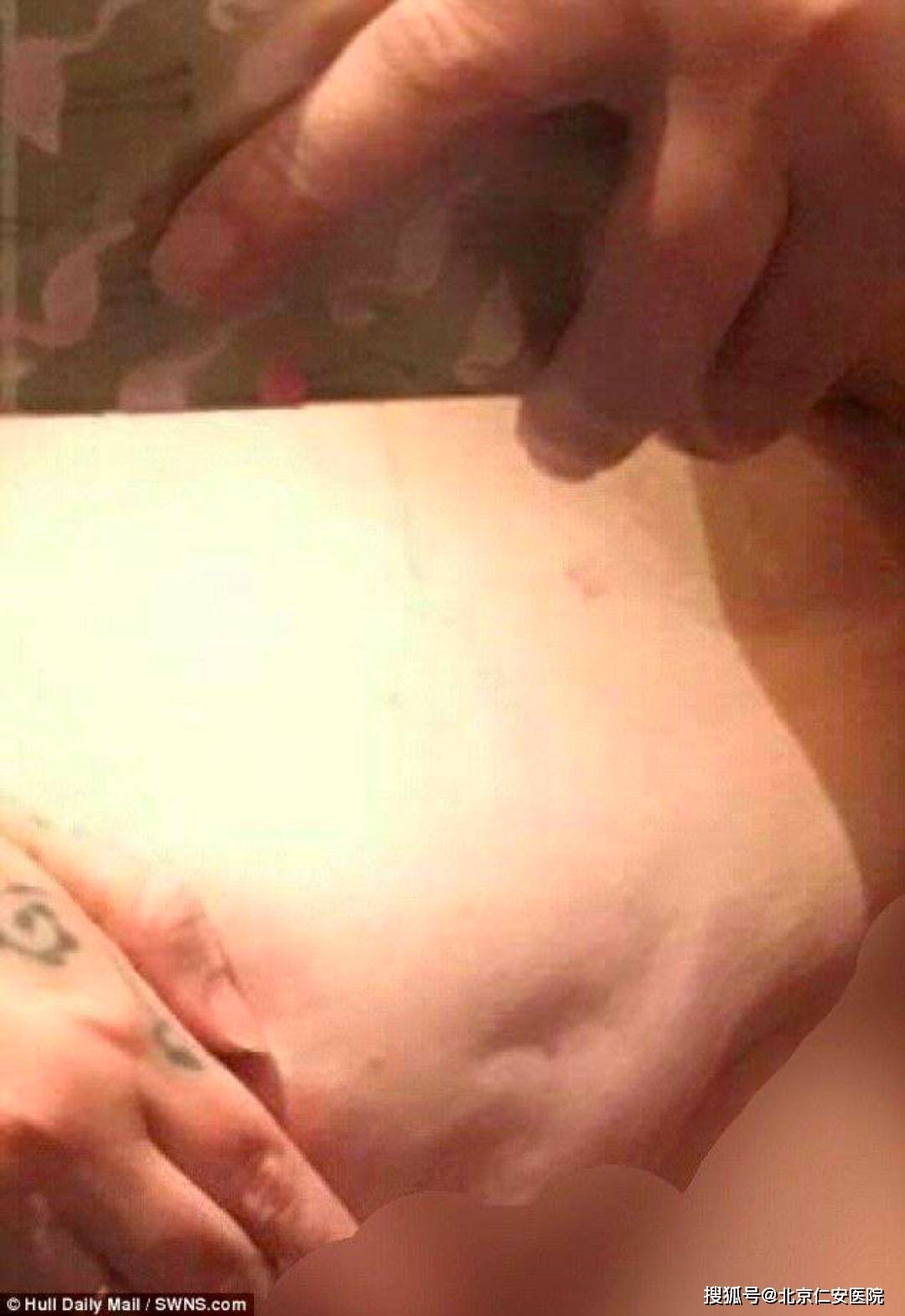 浙江又发现一例:浙江发现一例冠状病毒 浙江又发现一例:浙江发现一例冠状病毒