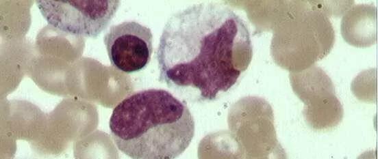 【安徽六安新增确诊病例2例/安徽六安新增1例疑似病例】