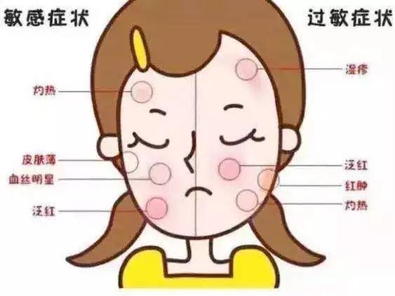 【过敏体质是不是不容易感冒/过敏是不是体质不好】