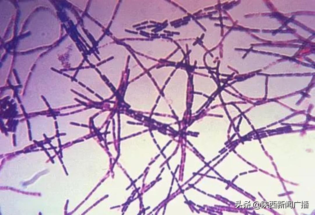 山西发生疑似皮肤炭疽疫情最新消息/山西发生疑似皮肤炭疽疫情怎么读