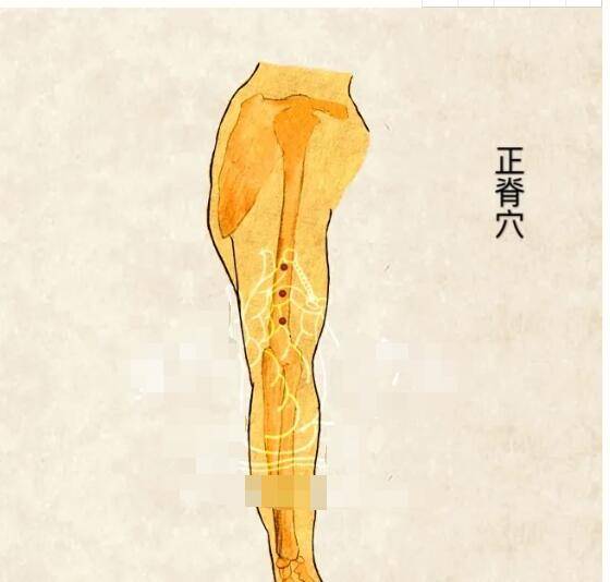 刘红云董氏针灸教程100集视频:刘红云富贵包一针治疗绝技