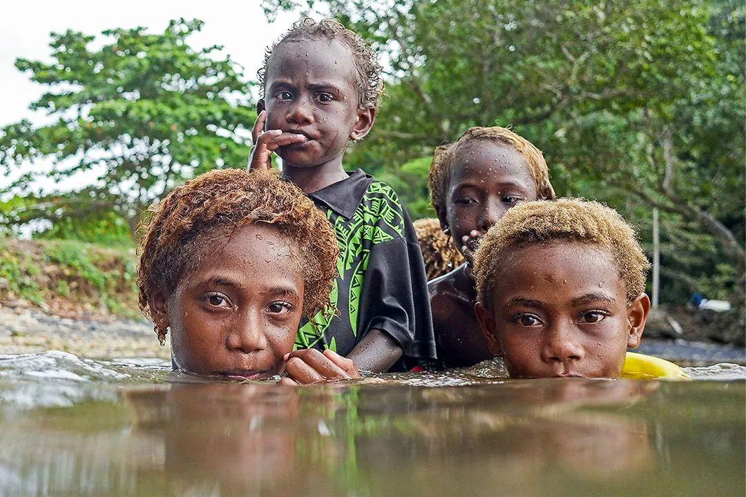 【抗体阳性是什么原因/抗梅毒螺旋体抗体阳性是什么原因】