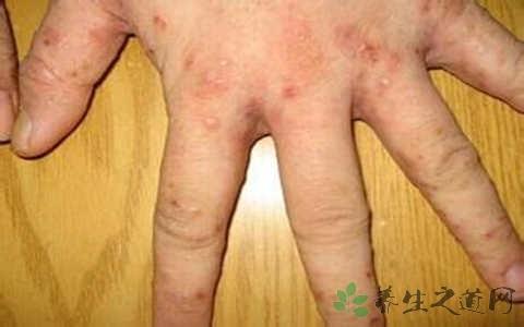 【无症状感染最新报道/无症状感染最新报道消息】